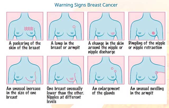 Breast Cancer Now on X: There's no right or wrong way to check your breasts  but it's important to #knowyourbody    / X